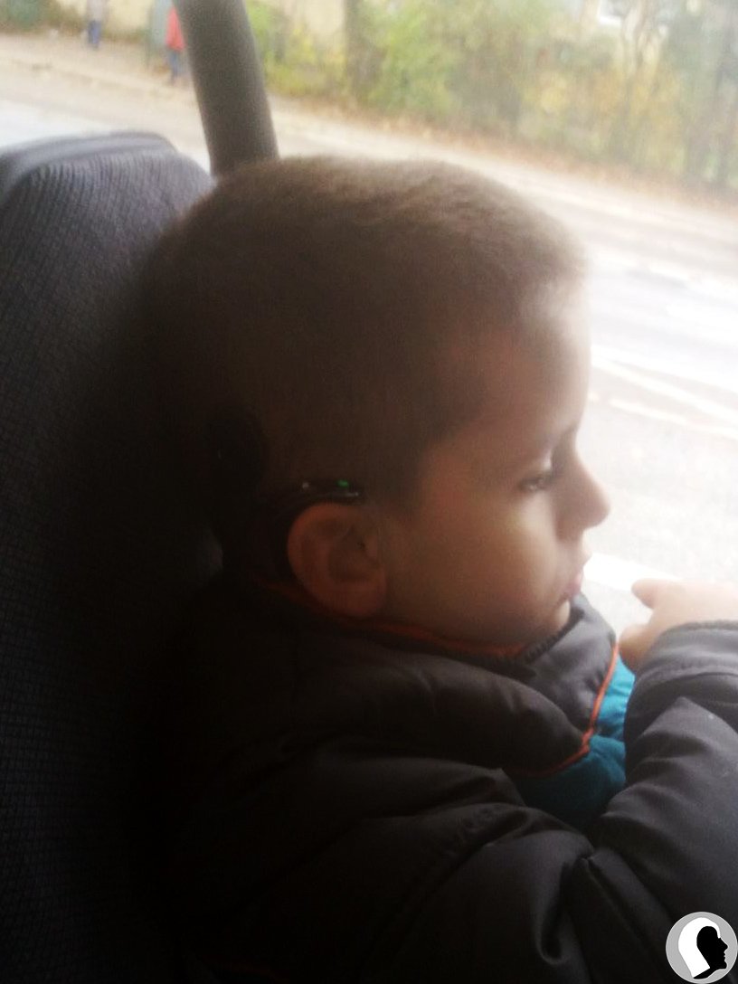 CI Kopf 2018 männlich Kind